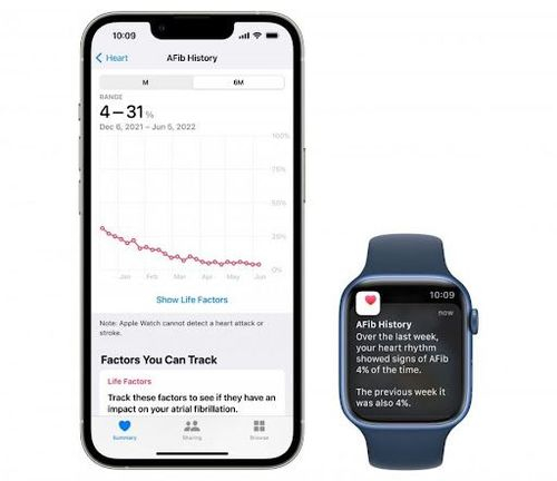 AFib History watchOS9.jpg