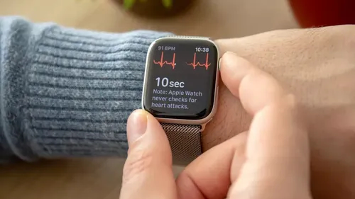 ECG Apple Watch